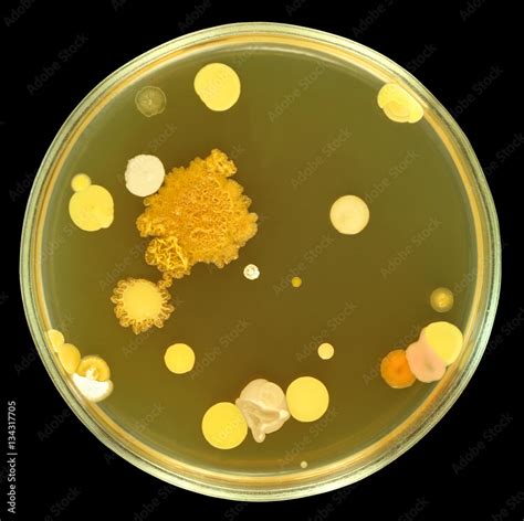 Big colorful colonies of bacteria on a petri dish (agar plate) isolated ...