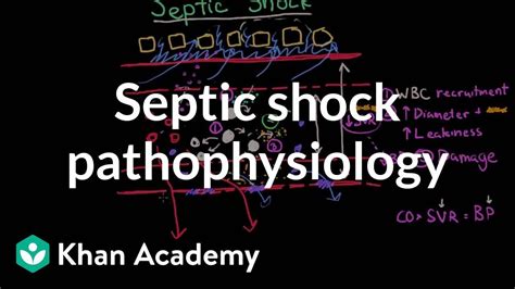 Toxic Shock Syndrome Pathogenesis