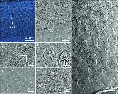 Enamel tubules in the tooth cross-section of Lambdopsalis bulla. (A-B)... | Download Scientific ...