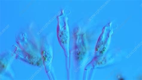 Epistylis ciliates, light microscope - Stock Video Clip - K005/6826 - Science Photo Library