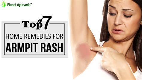 Itchy Armpit Rash Treatment