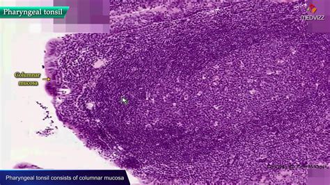 Pharynx Adenoid Epithelium Tonsil Histology Goblet Cell Carcinoid ...