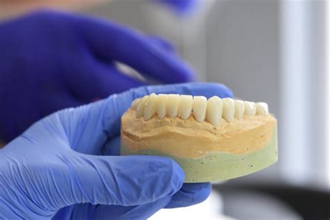 Stages of a Loose Tooth in Adults - Smile Cliniq