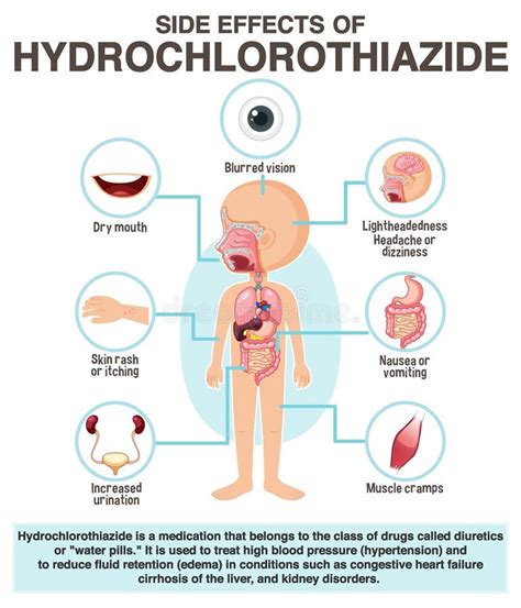 Human Anatomy Diagram Cartoon Style of Hydrochlorothiazide Side Effects Stock Vector ...