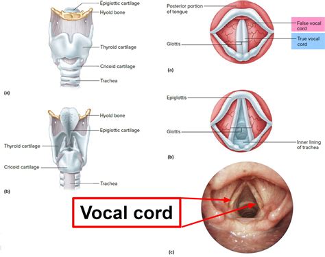 Vocal Cord Paralysis - Causes, Symptoms, Recovery, Surgery, Treatment