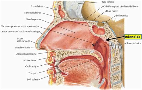 Adenoid Nose