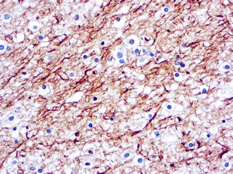 Neurofilaments – Mob080 – Diagnostic BioSystems (DBS)