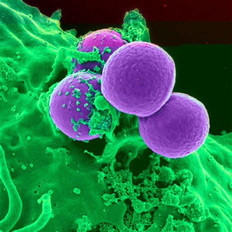 What Is A Mycoplasma Infection And What Are Its Symptoms?