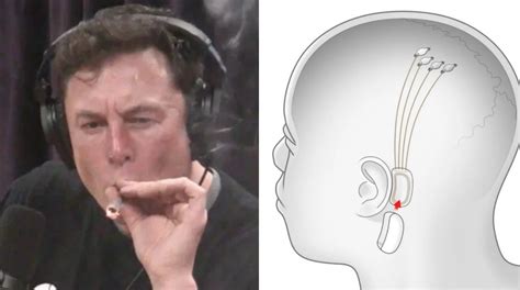 Elon Musk Says People Will Eventually Consume Music Through Brain Chip