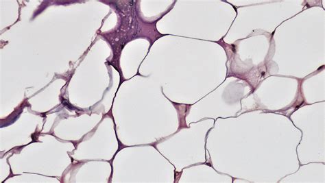 Adipose Connective Tissue Histology