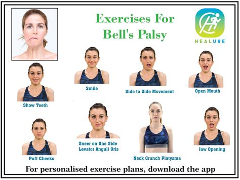 Facial Exercises For Bells Palsy Pictures - Exercise Poster