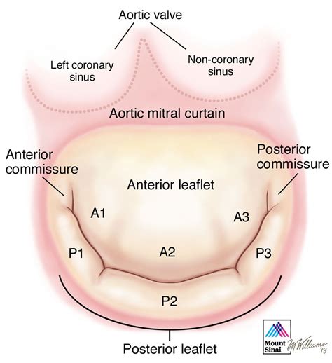 aortic mitral curtain | www.stkittsvilla.com