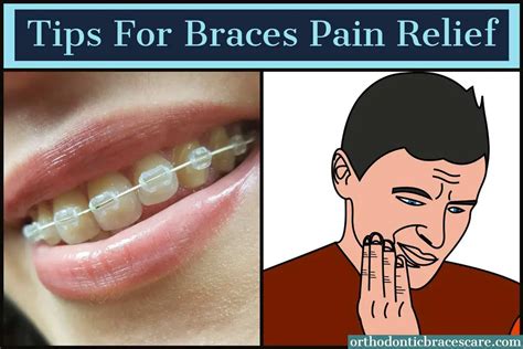 How To Relieve Pain From Braces [25+ Tips] - Orthodontic Braces Care