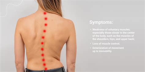 Spinal Muscle Atrophy: Symptoms, Causes and Treatment