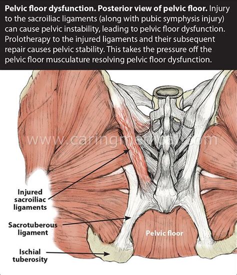 Pin on kinesiology