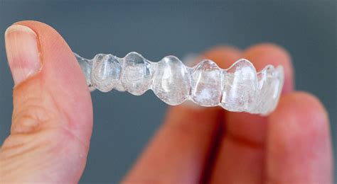 Metal Retainers vs. Clear Retainers: Which Is Better?