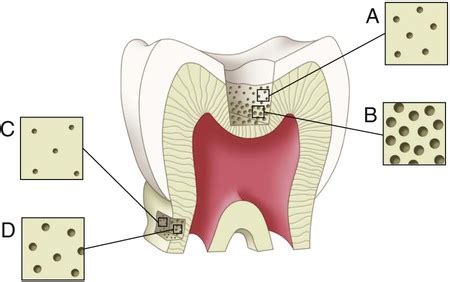 1: Clinical Significance of Dental Anatomy, Histology, Physiology, and Occlusion | Pocket Dentistry