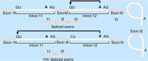 Splice-Site mutations in PKU