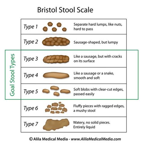 Types Of Stool