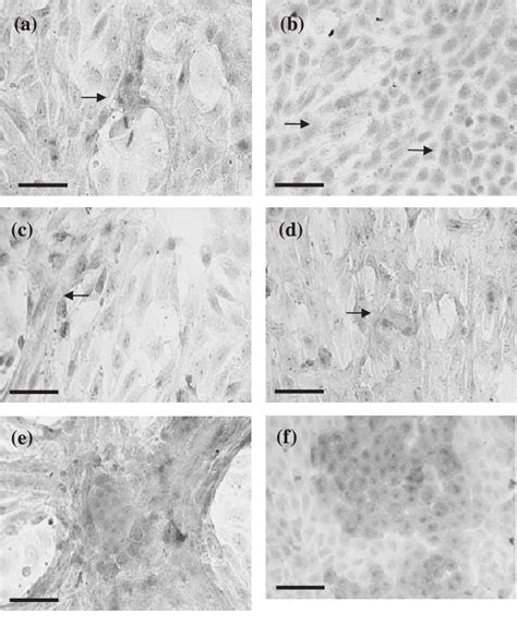 Lectin Dolichos biflorus agglutinin (DBA) staining of | Download Scientific Diagram