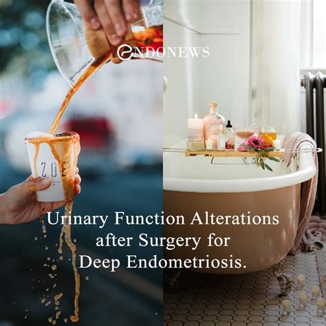 Urinary Function Alterations after Surgery for Deep Endometriosis ...