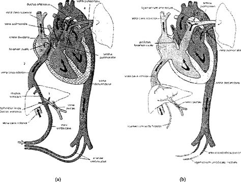 Figure 2.1 from Modelling the neonatal baroreceptor reflex function ...