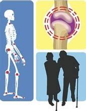 Infection Cancer: Skeletal System Diseases