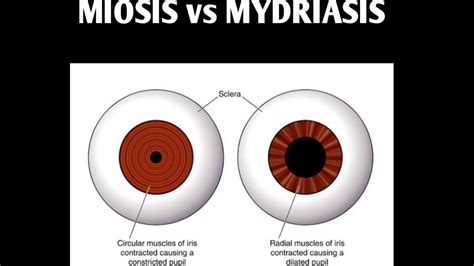 Miosis Definition