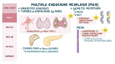 Video: Multiple endocrine neoplasia: Pathology review