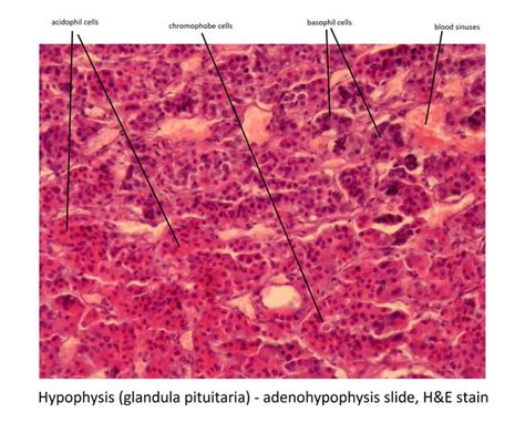 Hypophysis, detail (image) - WikiLectures