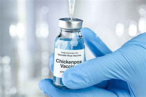 Chickenpox Vaccine For Children | Childhealthy London