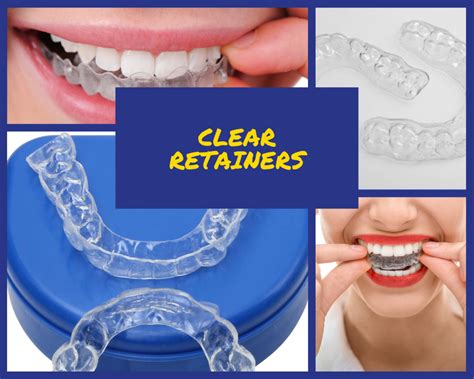 Clear Retainers | Maintain Your Hard to Get Smile with Clear Retainers