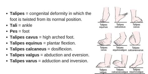 Clubfoot Causes Symptoms And Treatment