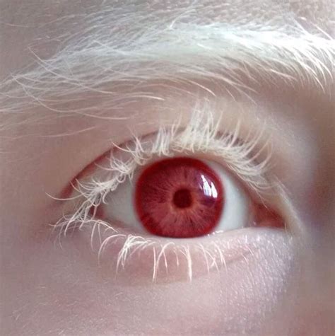 The Rarest Eye Color People Have | Flaming Truth