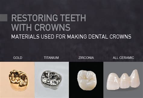 Best Dental Crown Material For Front Teeth - Teeth Poster