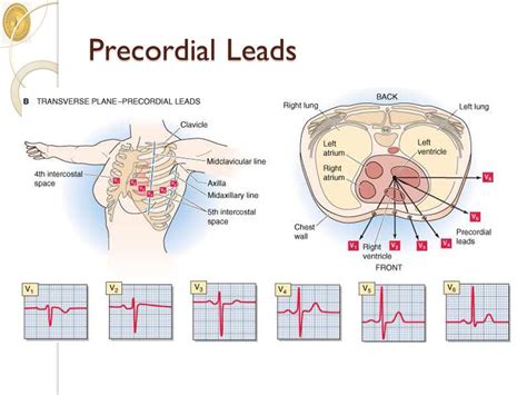 precordial leads | Medical knowledge, Ekg interpretation, Medical