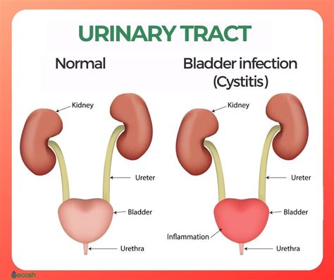 Urinary Bladder