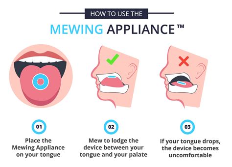 Mewing Appliance - Mewing Appliance