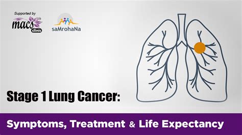 Stage 1 Lung Cancer: Symptoms, Treatment And Life Expectancy - Macs Blogs