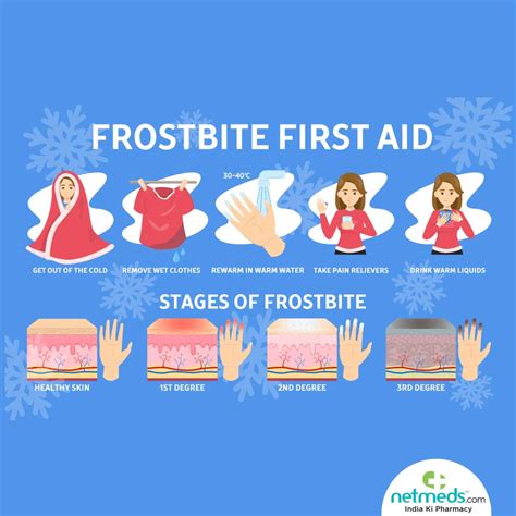 Frostbite Treatment