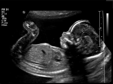 Ultrasound Wallpapers - Top Free Ultrasound Backgrounds - WallpaperAccess