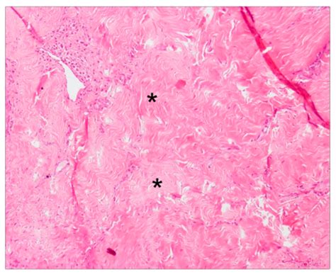 Mucogingival Junction Histology