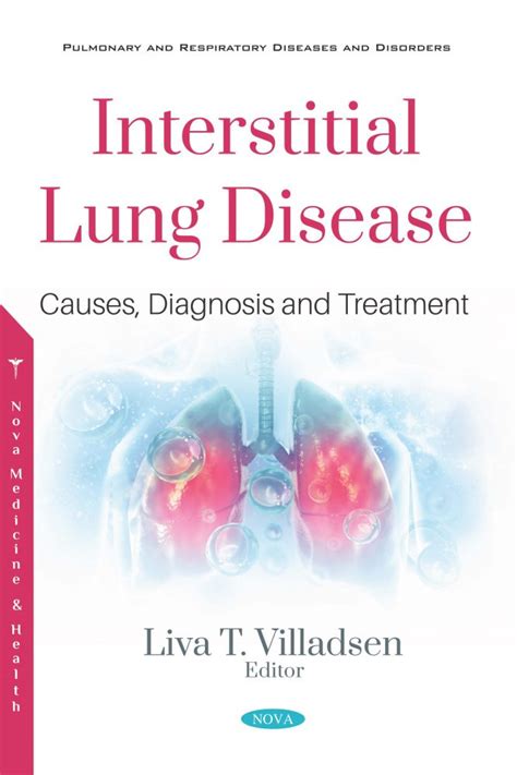 Interstitial Lung Disease: Causes, Diagnosis and Treatment – Nova ...