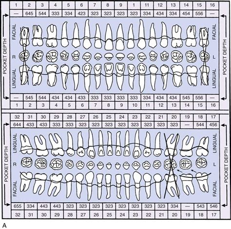 Periodontal Chart Online