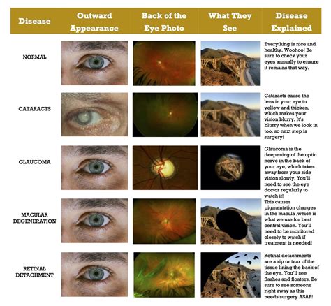 Eye Diseases Chart