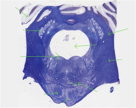 Histology "22 - lower pons Diagram | Quizlet