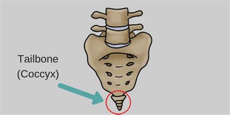 Tailbone Pain (Coccydynia): Causes & Pain Relief& exercise – Qutool® Store