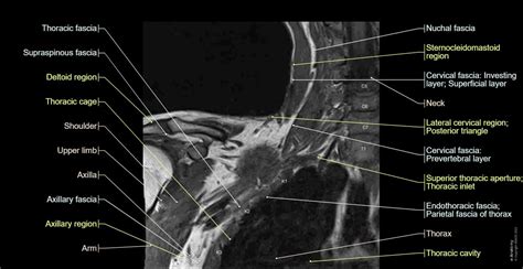 Brachial plexus MR: normal anatomy | e-Anatomy