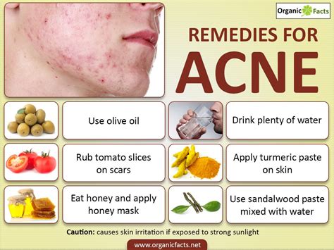 5 Home Remedies to Treat and Get Rid of Pimples | HubPages