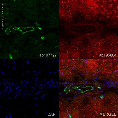 Alexa Fluor® 488 Anti-Endothelial Cell antibody [RECA-1] (ab197727) | Abcam